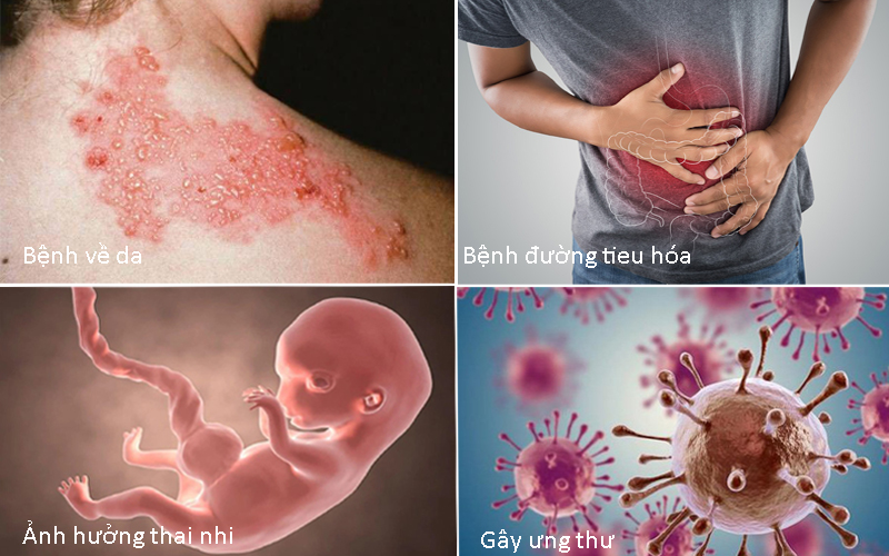 Một số hậu quar của ô nhiễm nguồn nước đến sức khỏe con người