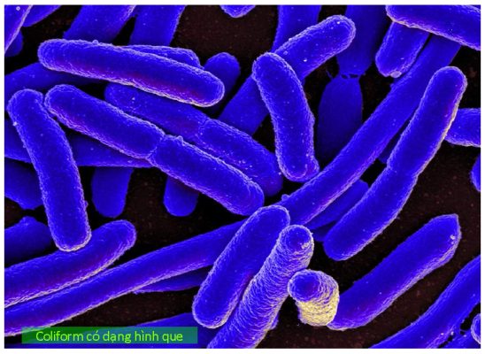 Vi khuẩn Coliform có dang hình que có thể tồn tại trong nước và thực phẩm, gây hại cho sức khỏe con người